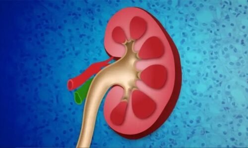 NIH Study: Breakthrough in Kidney Disease Research for West Africans